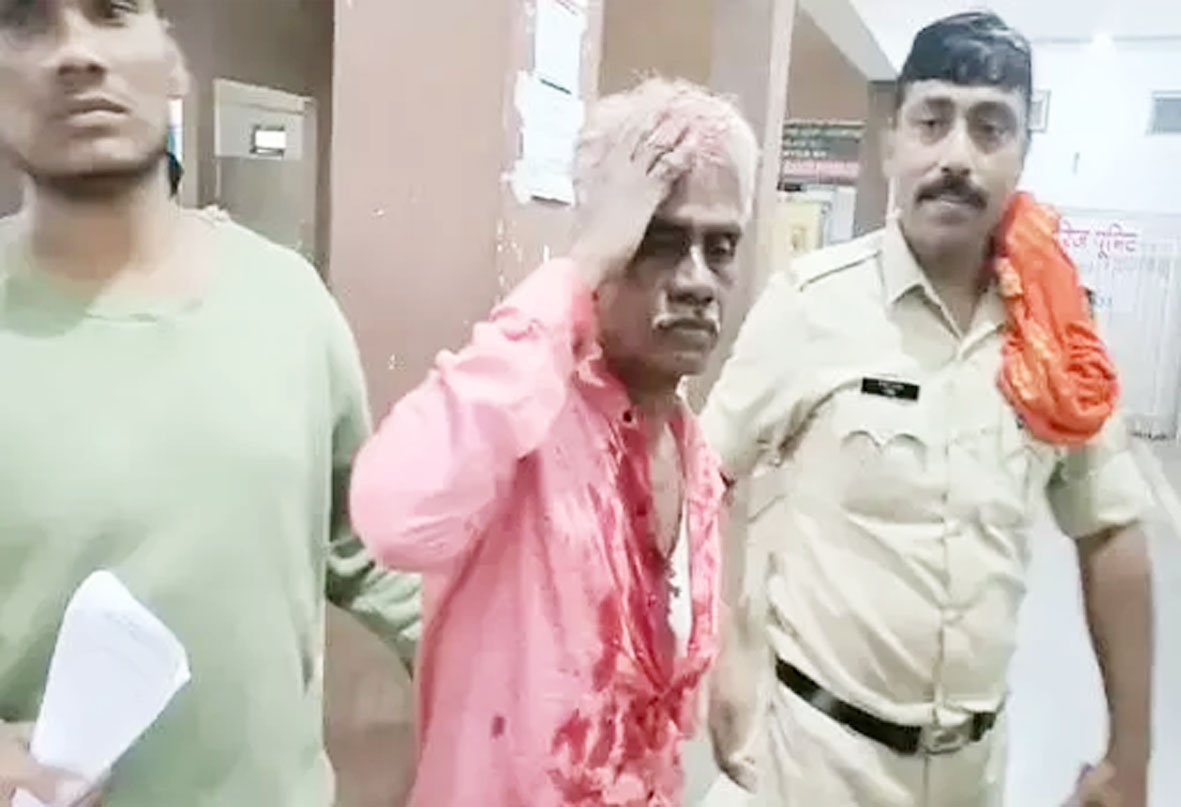 पार्षद के परिजन की हत्या की कोशिश, हमले में पिता लहूलुहान