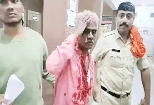 पार्षद के परिजन की हत्या की कोशिश, हमले में पिता लहूलुहान